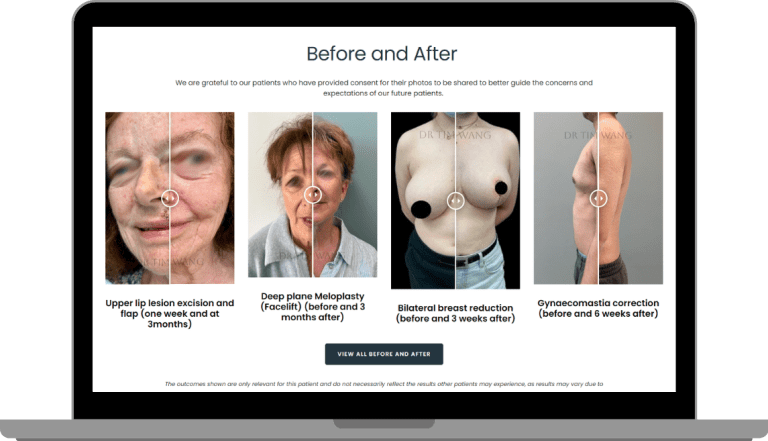 Before & After Gallery with Slider